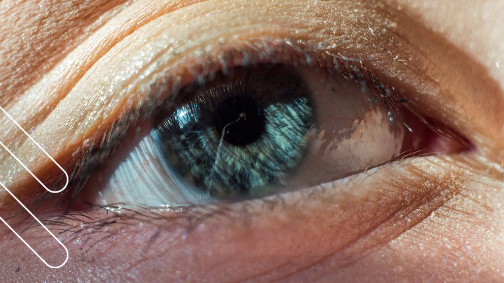 Melanoma Ocular Un Tipo De Cáncer De Ojo Que Debes Conocer 