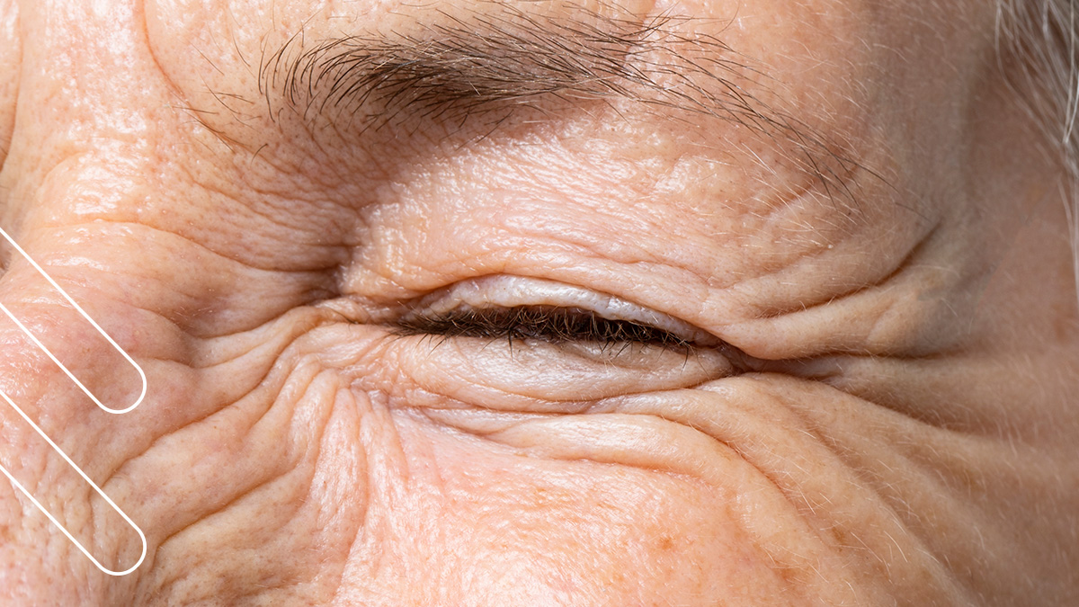 envejecimiento ocular ojos
