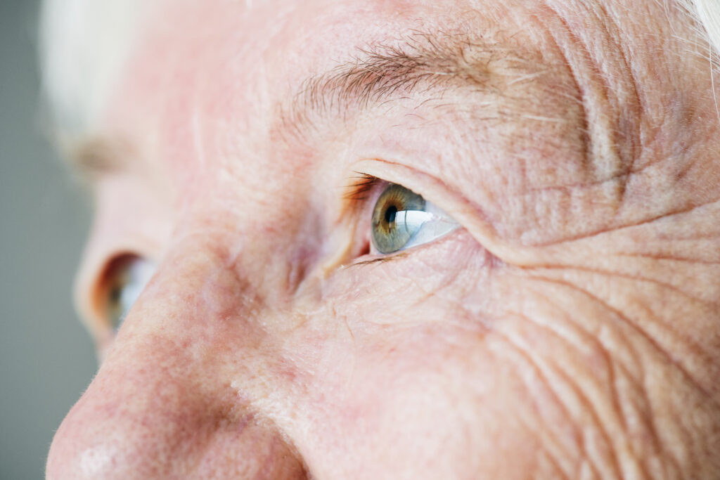 Nuevo tratamiento láser glaucoma ICQO