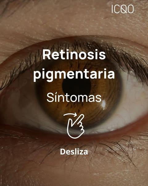 tratamiento de retinosis pigmentaria en Bilbao