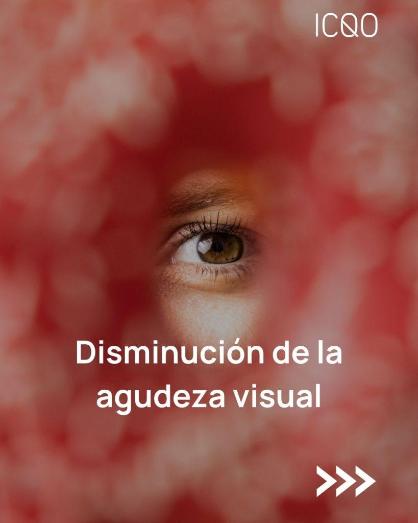 tratamiento de retinosis pigmentaria en Bilbao