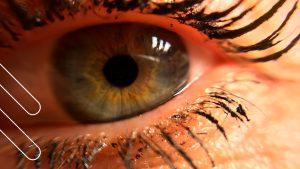 dolor ocular crónico, microscopia confocal