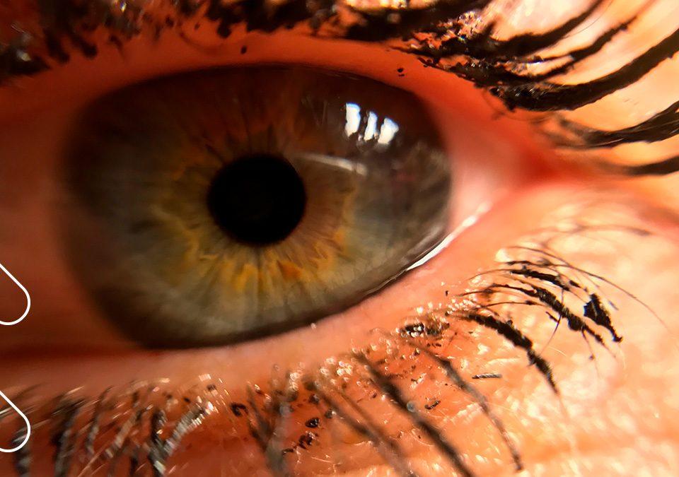 dolor ocular crónico, microscopia confocal