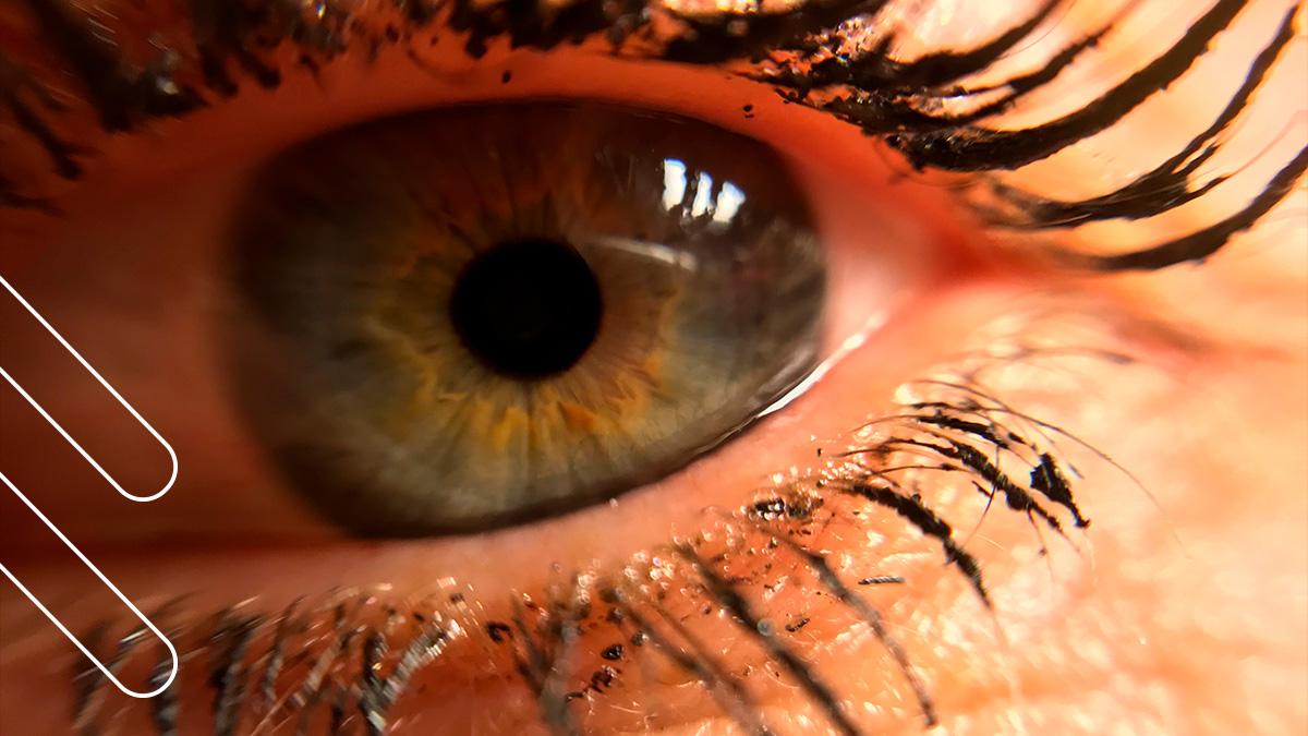 dolor ocular crónico, microscopia confocal